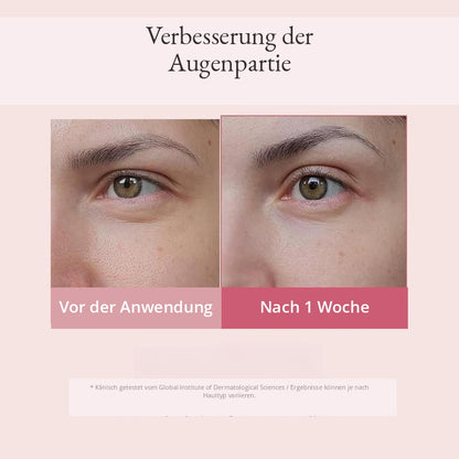 Augenserum - PDRN & Retinol-Komplex für sichtbar straffere und frischere Augenpartien
