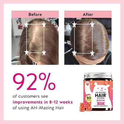 Biotin Hair Gummies – 5000mcg High Potency Formula For Thicker Fuller Hair