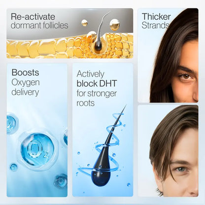 Advanced Hair Density Serum with Roller Scalp Massager – Thicker, Fuller Hair in 90 Days