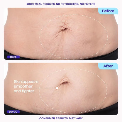 Body Firming Cream – Multi-Peptide Lifting Mechanism For Firmer, Tighter Stomach Skin