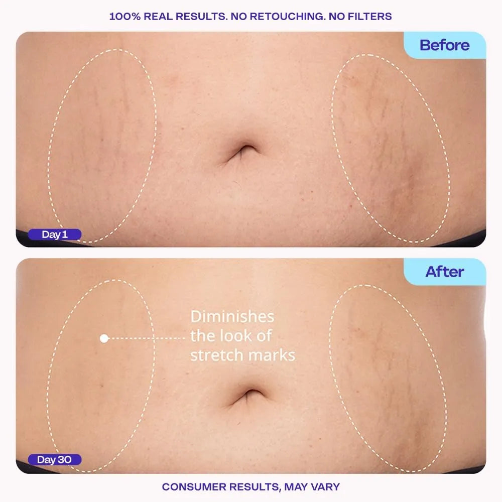Body Firming Cream – Multi-Peptide Lifting Mechanism For Firmer, Tighter Stomach Skin