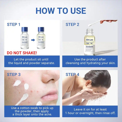 1.8% Salicylic Acid Acne Treatment – 24H Overnight Shrinkage For Clear Acne-Free Skin